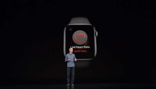 La politique de remboursement d'Apple Watch de 45 jours serait liée aux fonctionnalités de santé cardiaque, y compris l'application ECG
