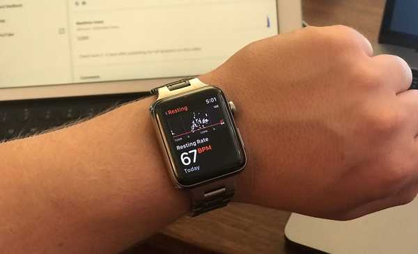 So aktivieren Sie potenziell lebensrettende Benachrichtigungen über erhöhte Herzfrequenz auf der Apple Watch