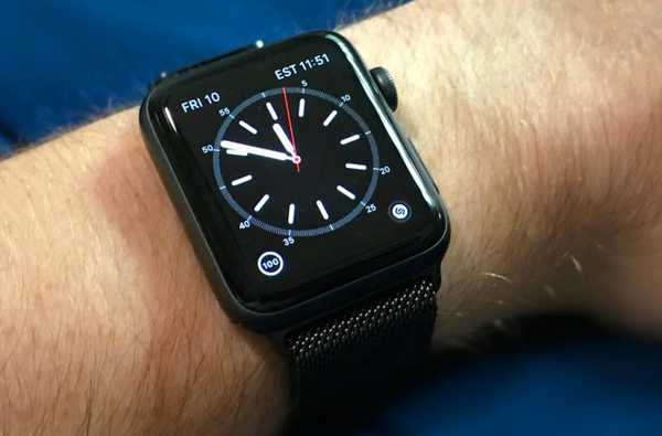 Apple startet Bildschirmaustauschprogramm für Apple Watch Series 2 und Series 3 aus Aluminium