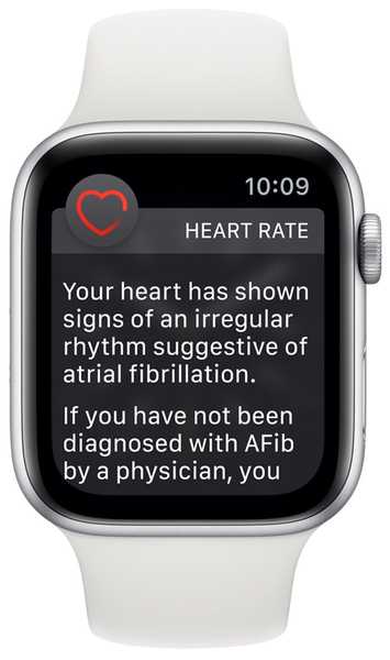 L'Apple Watch è stato accreditato per aver rilevato l'anomalia del cuore del proprietario